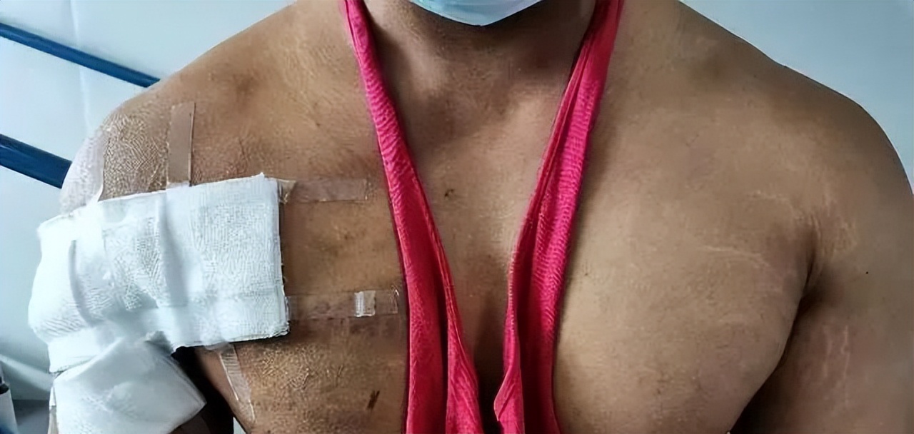 卧推200kg被砸,小伙卧推失误被锁喉过程揪心