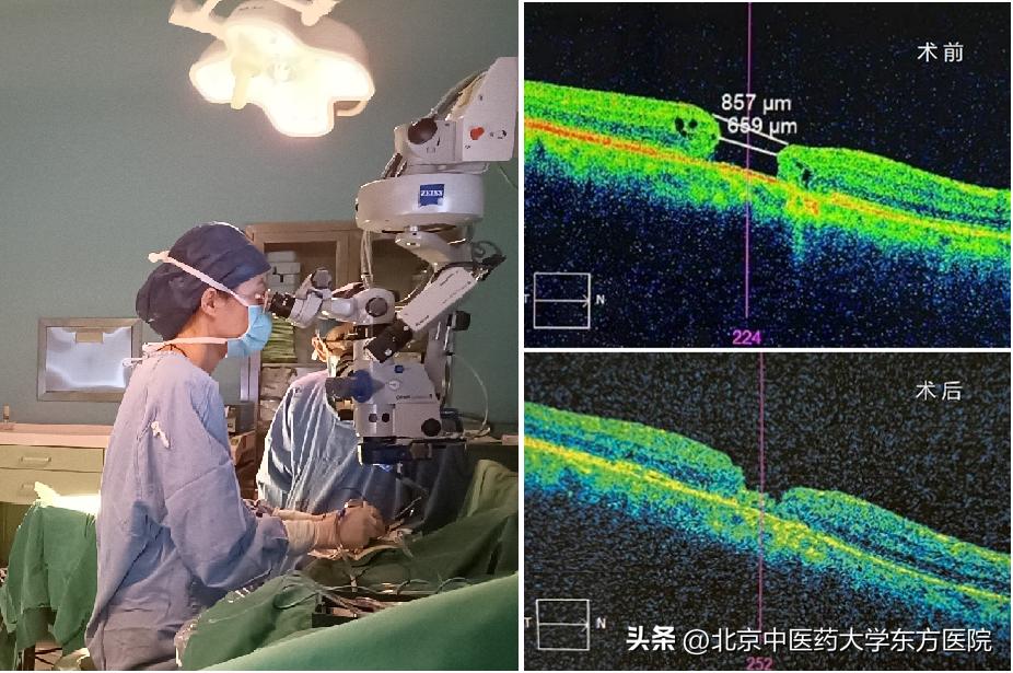 北京中医药大学东方医院项目,北京市中医药大学东方医院眼科