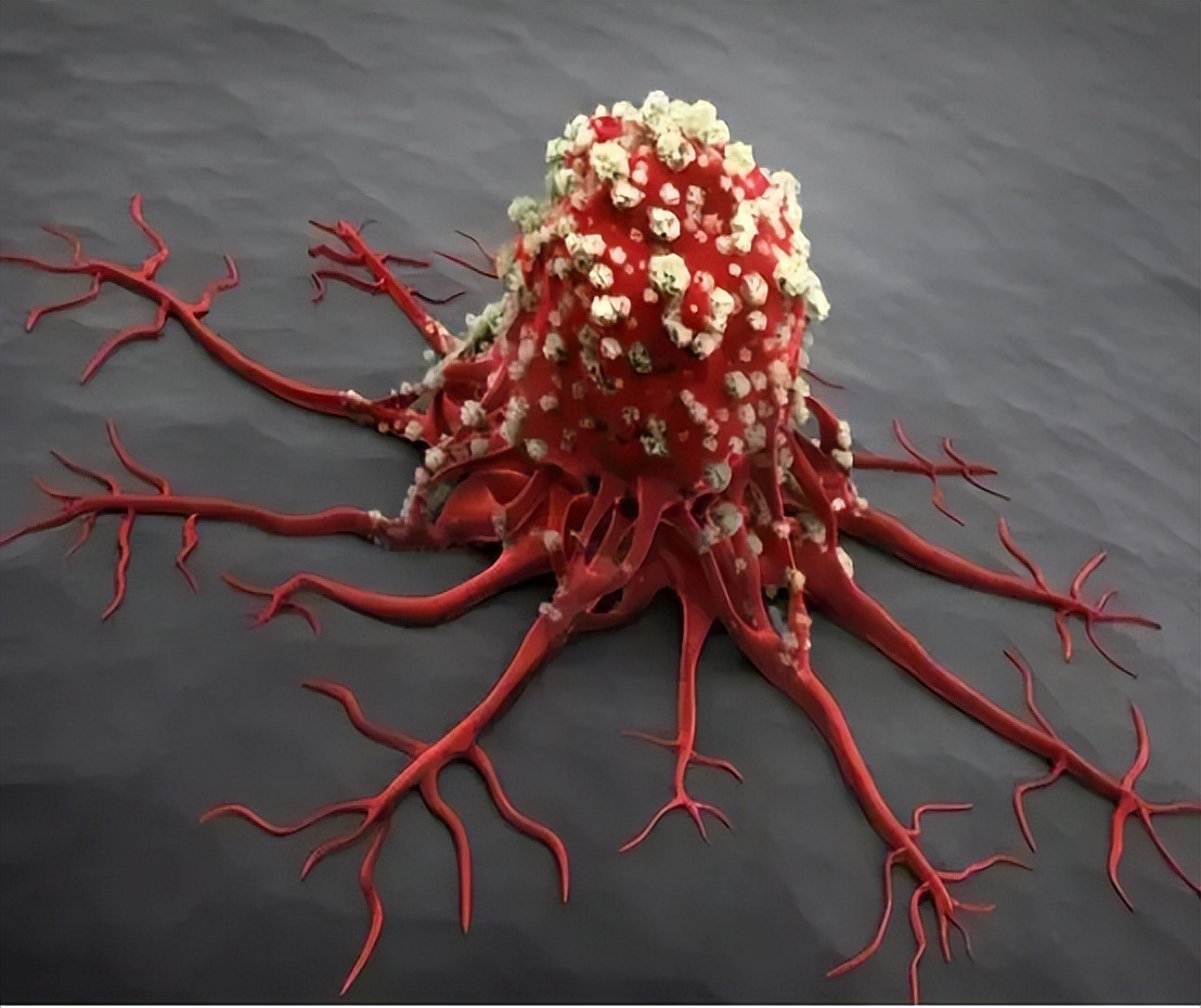 癌症根本不用治治好的都是误诊,癌症不用治治好的都是误诊