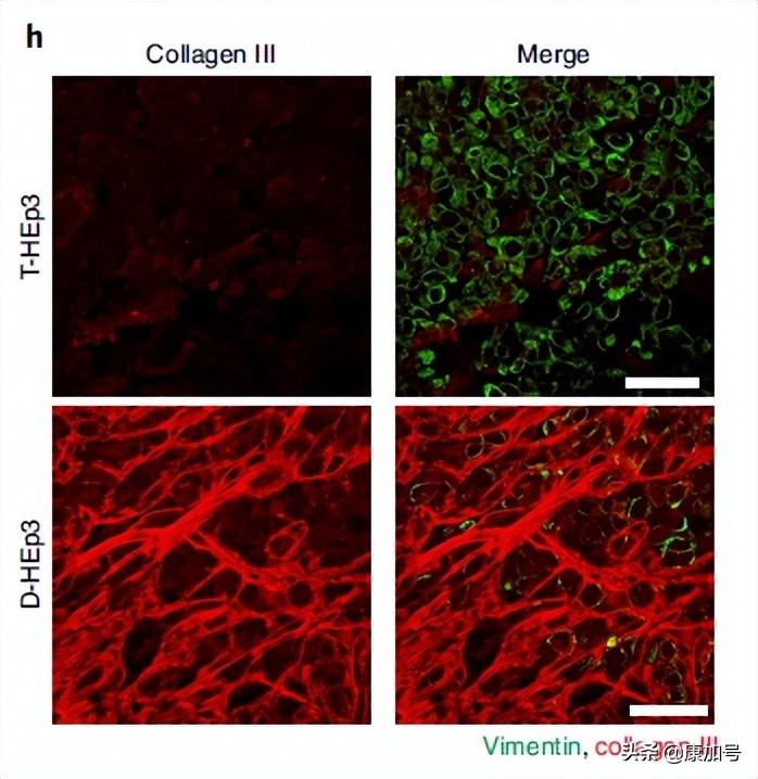 新的突破是什么,新的突破