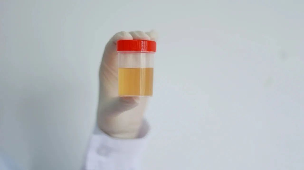 非淋菌性尿道炎男性主要症状,男性支原体尿道炎症状