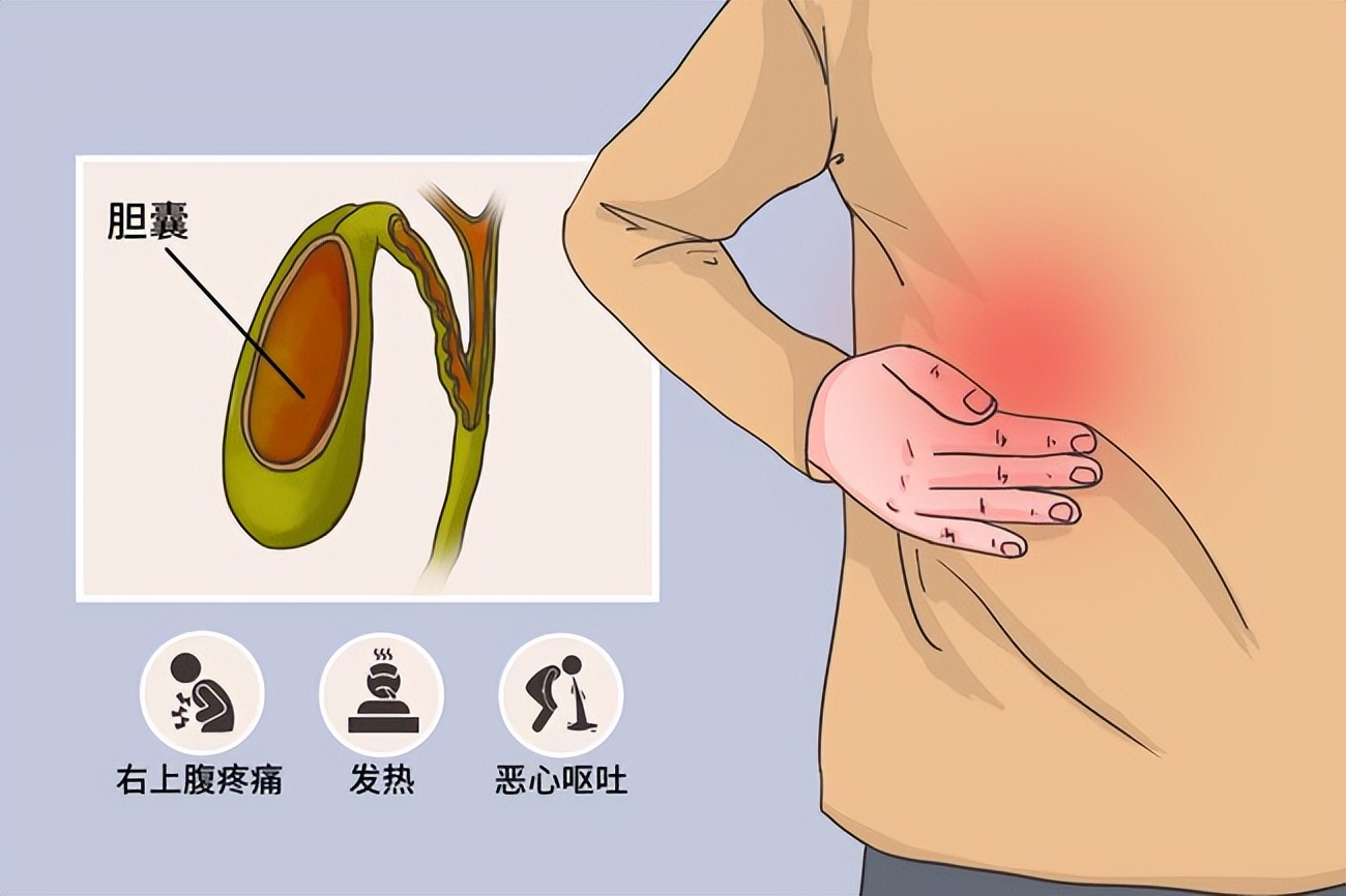 胆结石患者中药怎么治疗,胆结石的食疗偏方大全