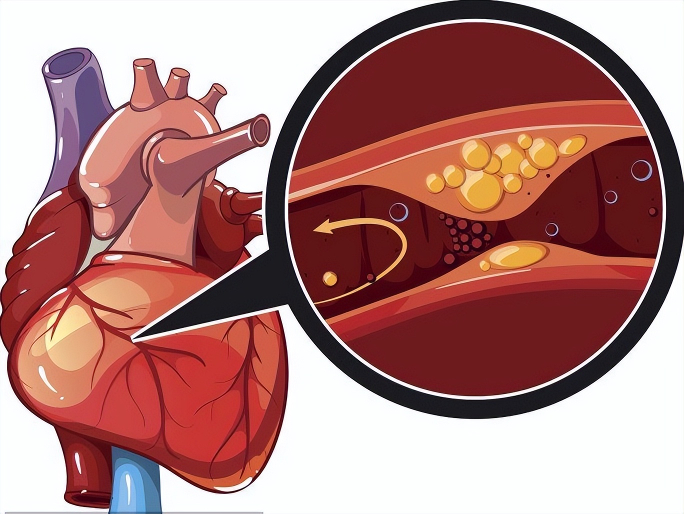 心梗时使用速效救心丸可以急救吗,心梗急救药有用吗