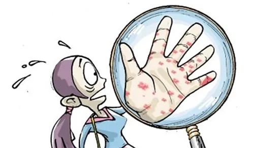 消除艾梅乙母婴传播的意义,关爱女性健康传递爱正能量