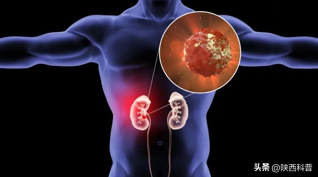 爱吃醋的人身体会更健康,爱吃醋的人会离健康更近吗