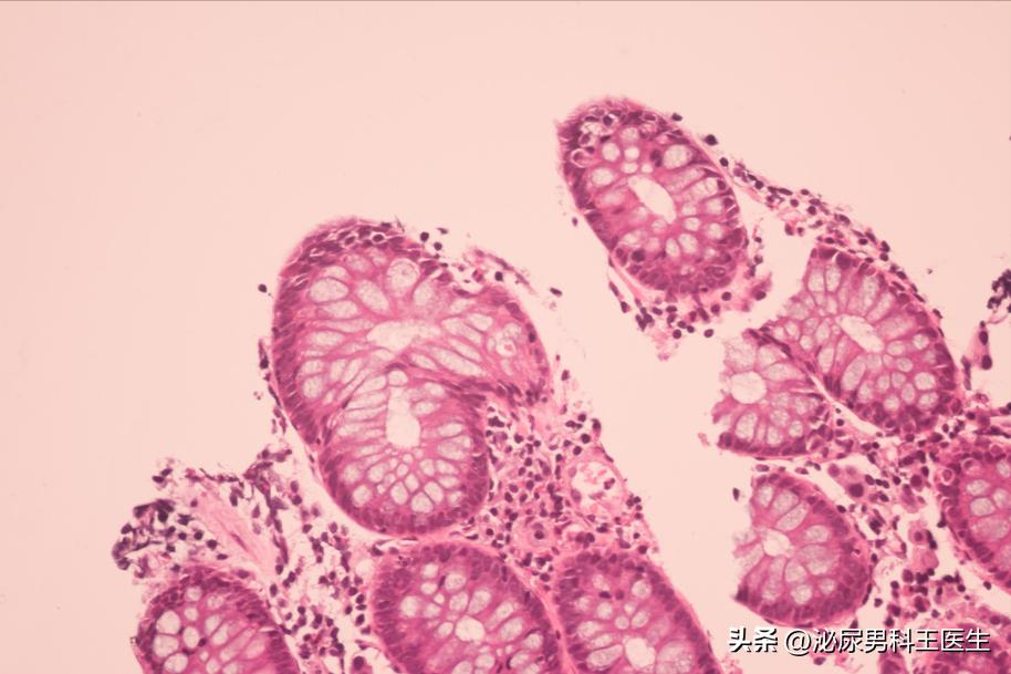 没有和女性接触的人会感染hpv吗,hpv除了性接触还有什么感染途径