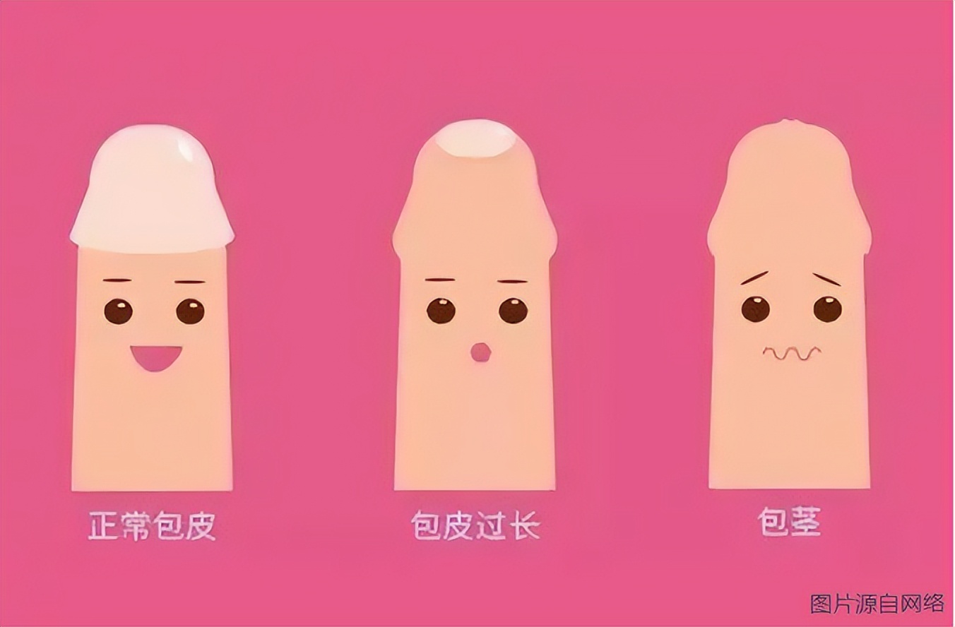 包皮过长的坏处对另一半的危害,包皮过长对身体有哪些害处