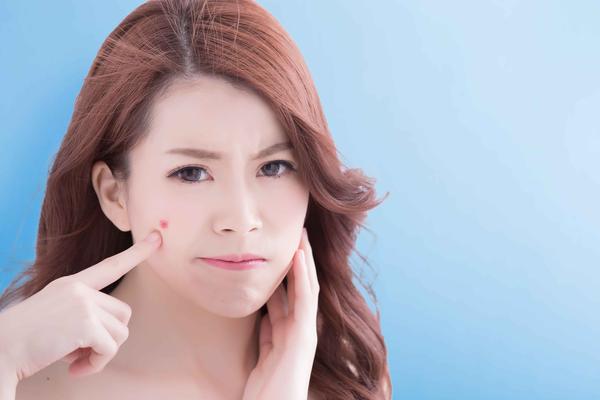 脸上长痘痘了怎么办最简单的方法,脸上长痘痘怎么办最简单的方法