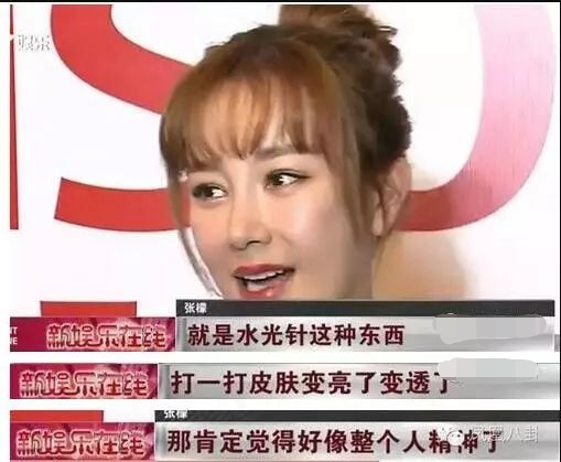 吴刚演员的脸有整容吗,吴刚演员整过容吗