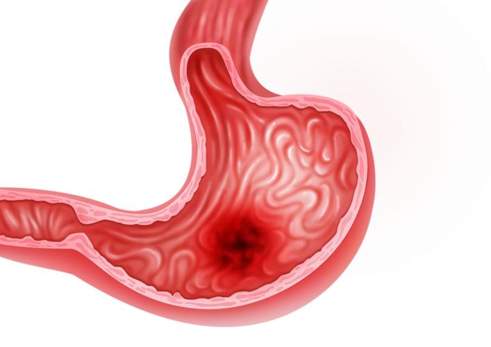 多吃辣有什么好处和坏处,吃辣有哪些好处和坏处