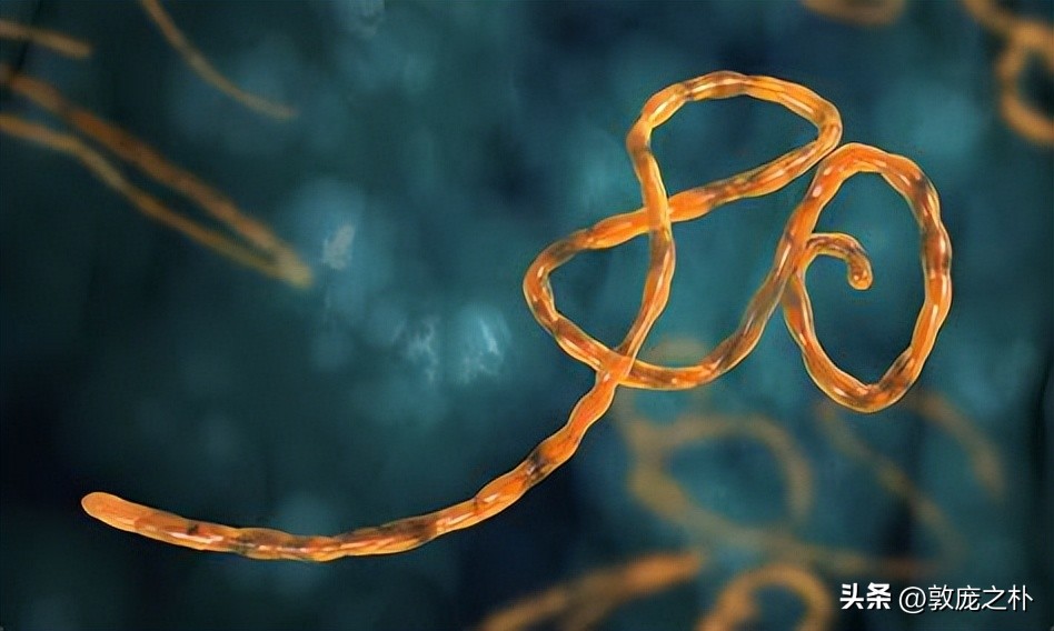 地球上十大可怕的病毒,地球上最厉害的十种病毒都是什么