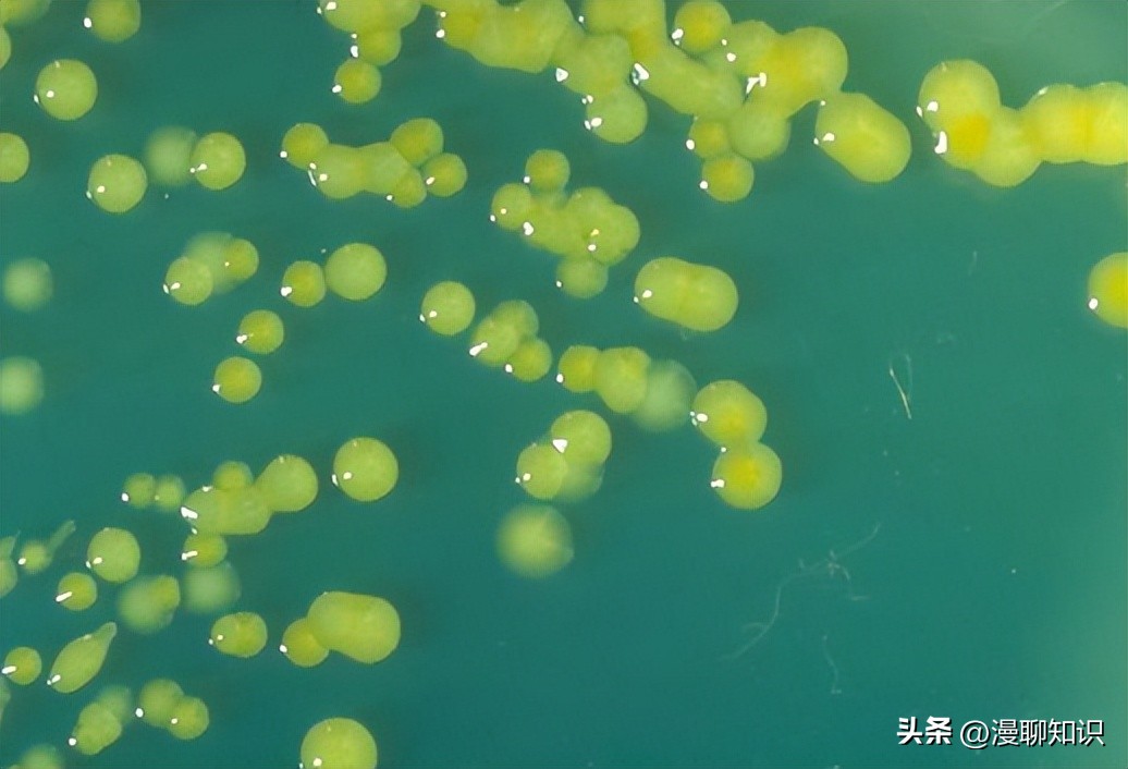 抑制幽门螺旋杆菌的乳酸菌,抑制幽门螺杆菌的乳酸菌