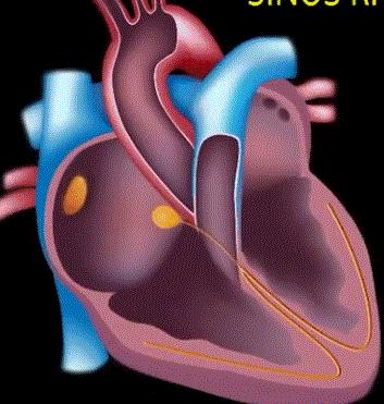 什么样的运动会对心脏更有好处呢,多大的运动量对心脏最好