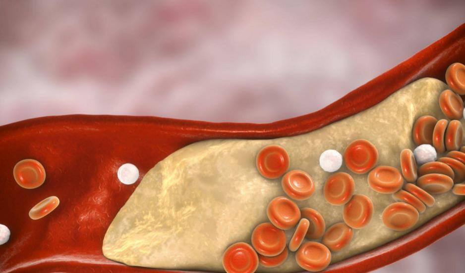 心血管疾病能常吃核桃吗,心血管疾病可以多吃核桃吗