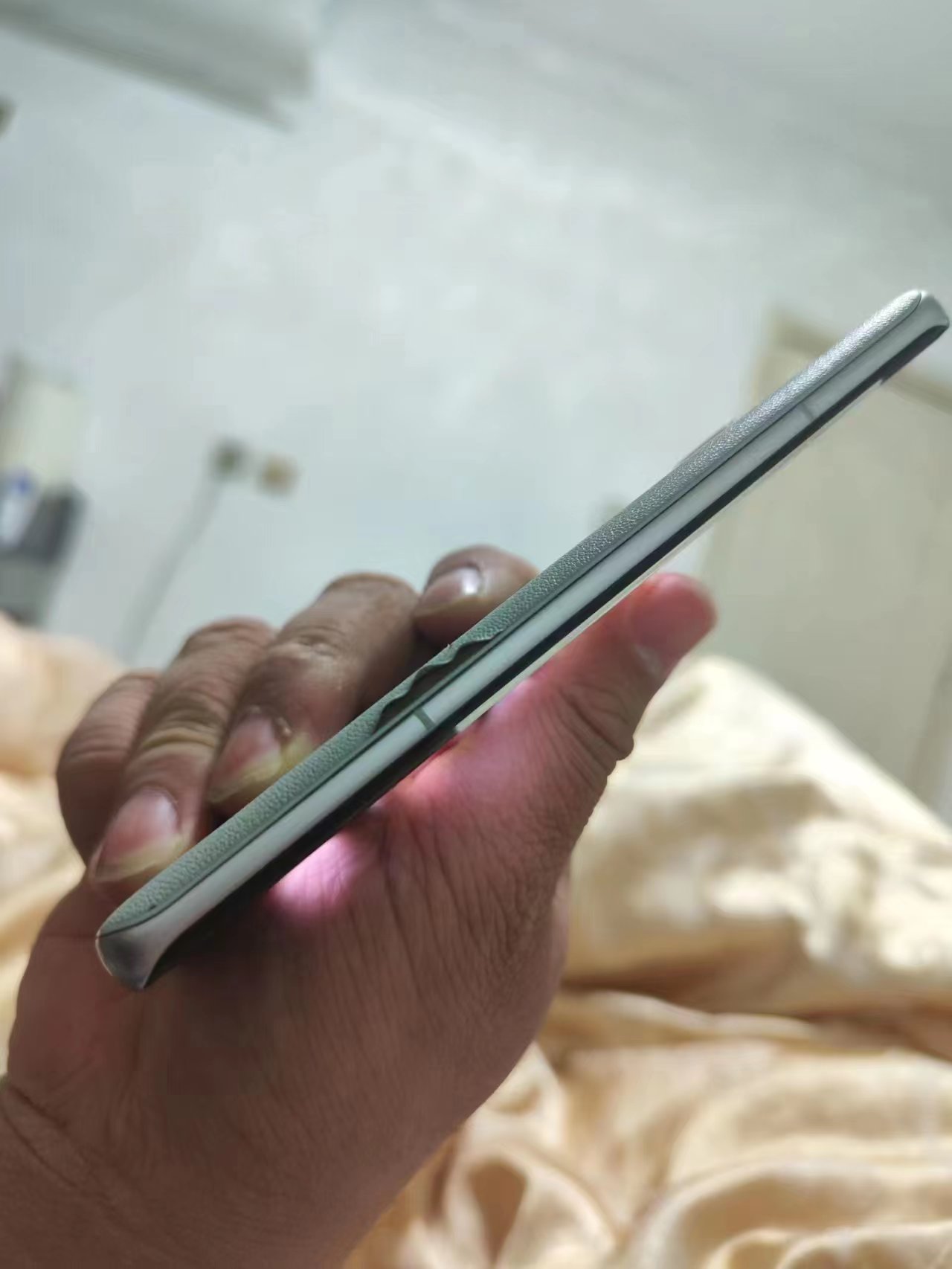 小米手机老化问题能免费保修吗 (小米手机后盖脱胶小米官方管吗)