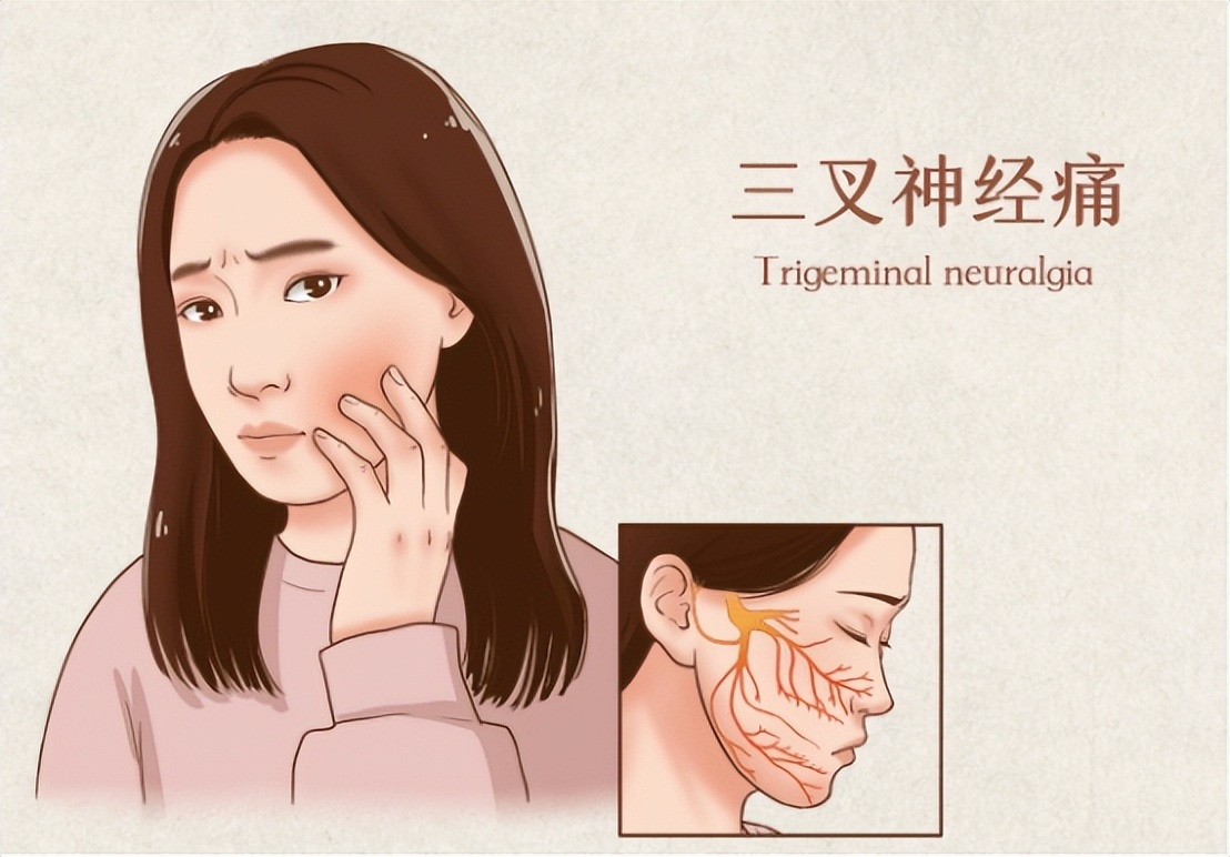 三叉神经痛伽玛刀可以维持多久,三叉神经痛伽玛刀有哪些副作用