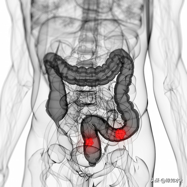 拉肚子是一种什么感觉,如何体验拉肚子的感觉和症状
