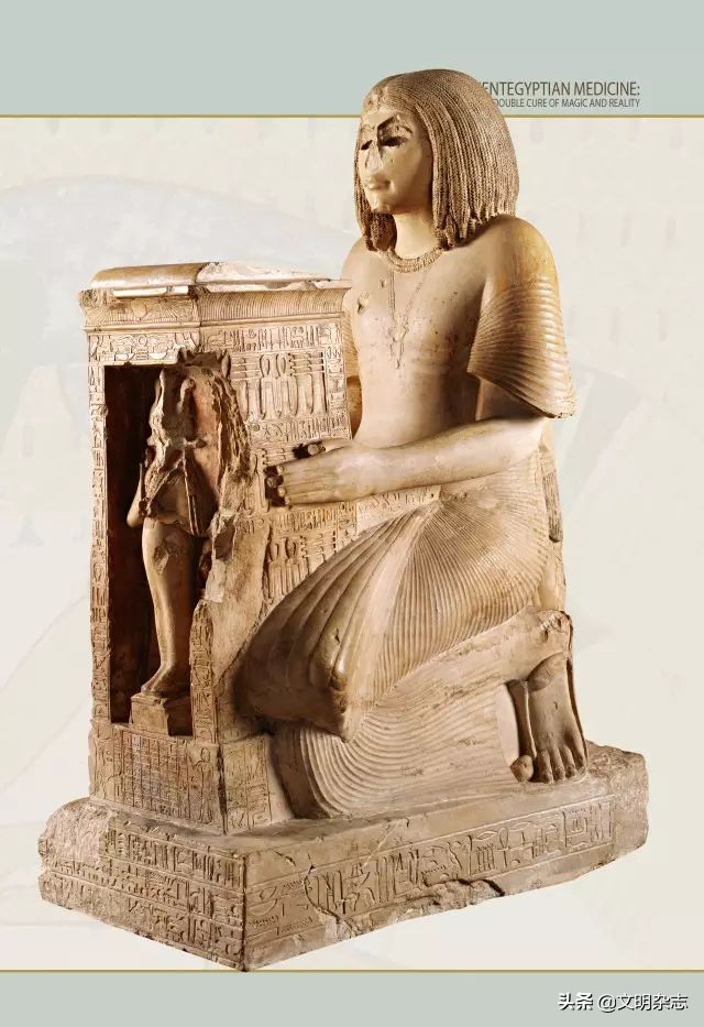 古埃及的医学和智慧之神,古埃及医学震惊众人