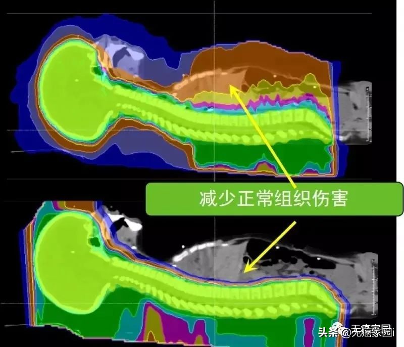 5年生存率超过90%是不是治疗率高,5年生存率图