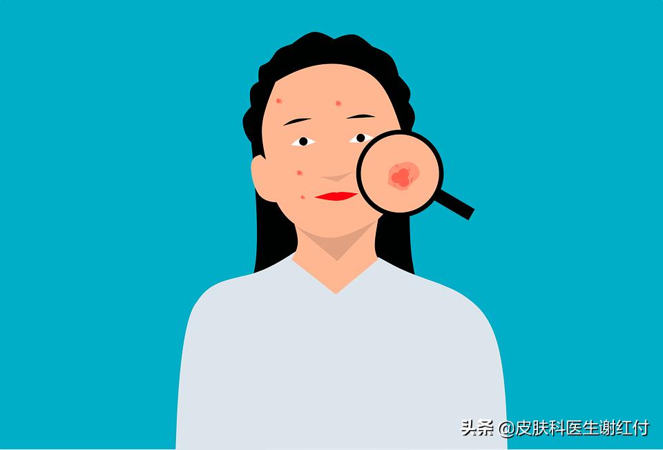 长了5年痘痘有救吗,痘痘反复长不要慌教你正确祛痘