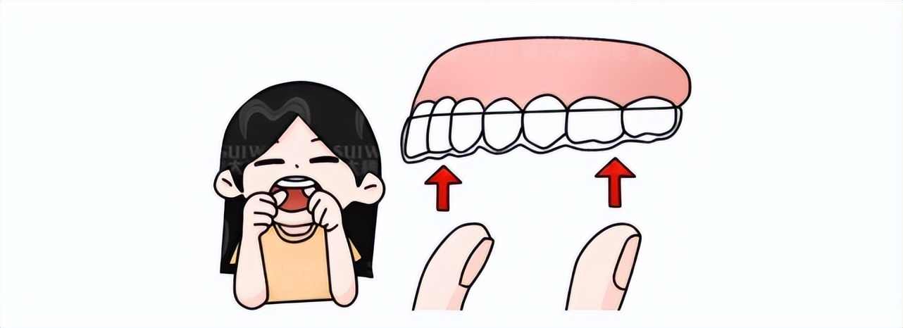 刚做完牙套怎么能快速恢复,戴牙套最难熬的阶段要怎么处理