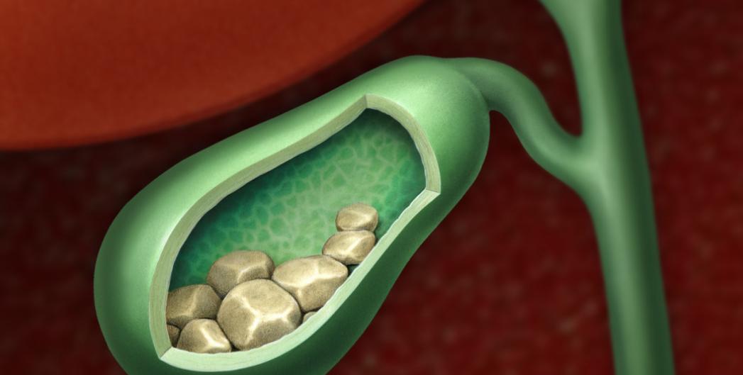 胃痛不一定是胃病,胃痛不是病疼得要人命