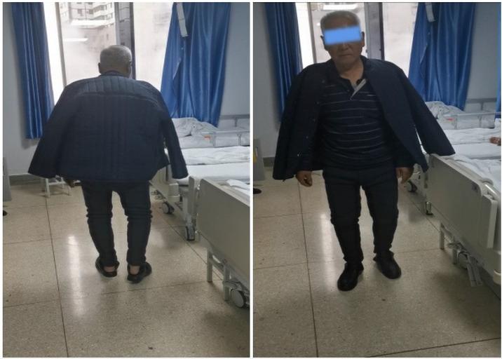 西安红会医院治疗癫痫怎么样,西安红会医院看帕金森