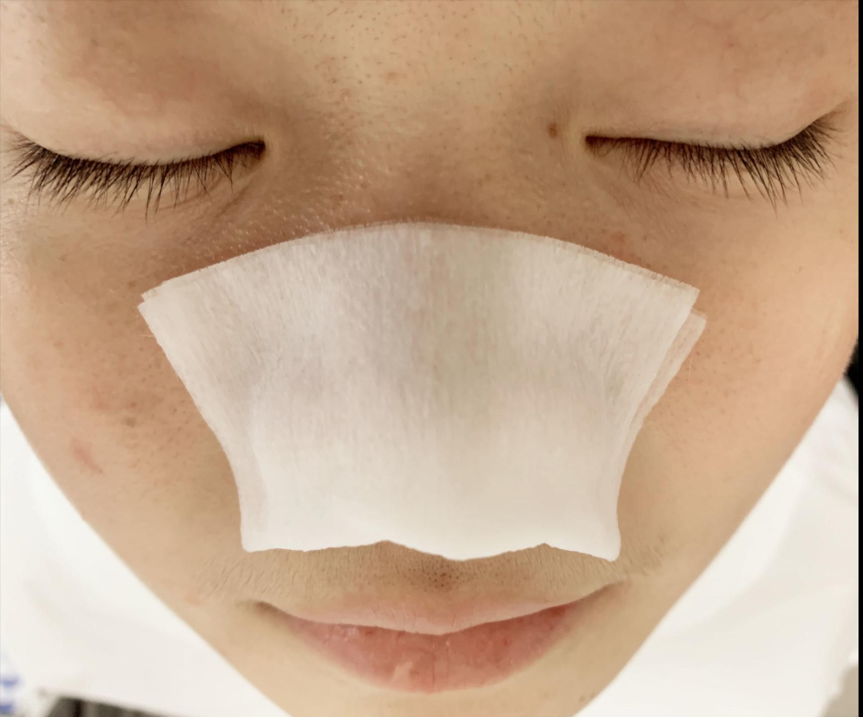 去除鼻子黑头收缩毛孔小妙招,鼻子黑头毛孔大抹什么药膏