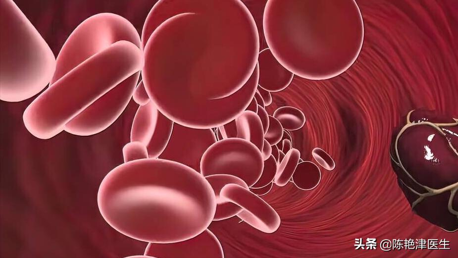 突发脑梗的五个信号,脑血栓脑袋滋滋的声音