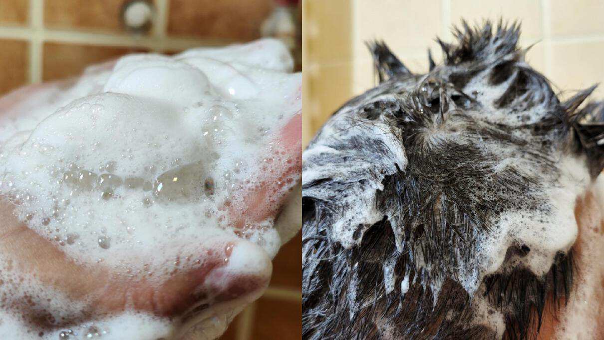 去头皮屑防掉发的洗发水推荐,脱发痒用哪一款洗发水比较好