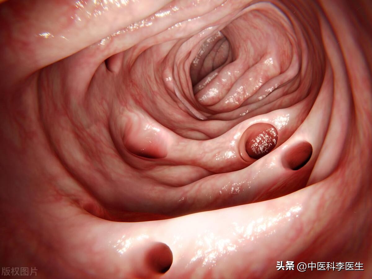 为什么这么多人最怕做肠镜,院士说肠镜一次可以保几年