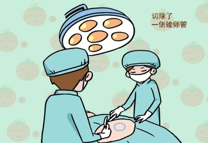 宫外孕腹腔出血的真实经历,医学科普宫外孕知识分享