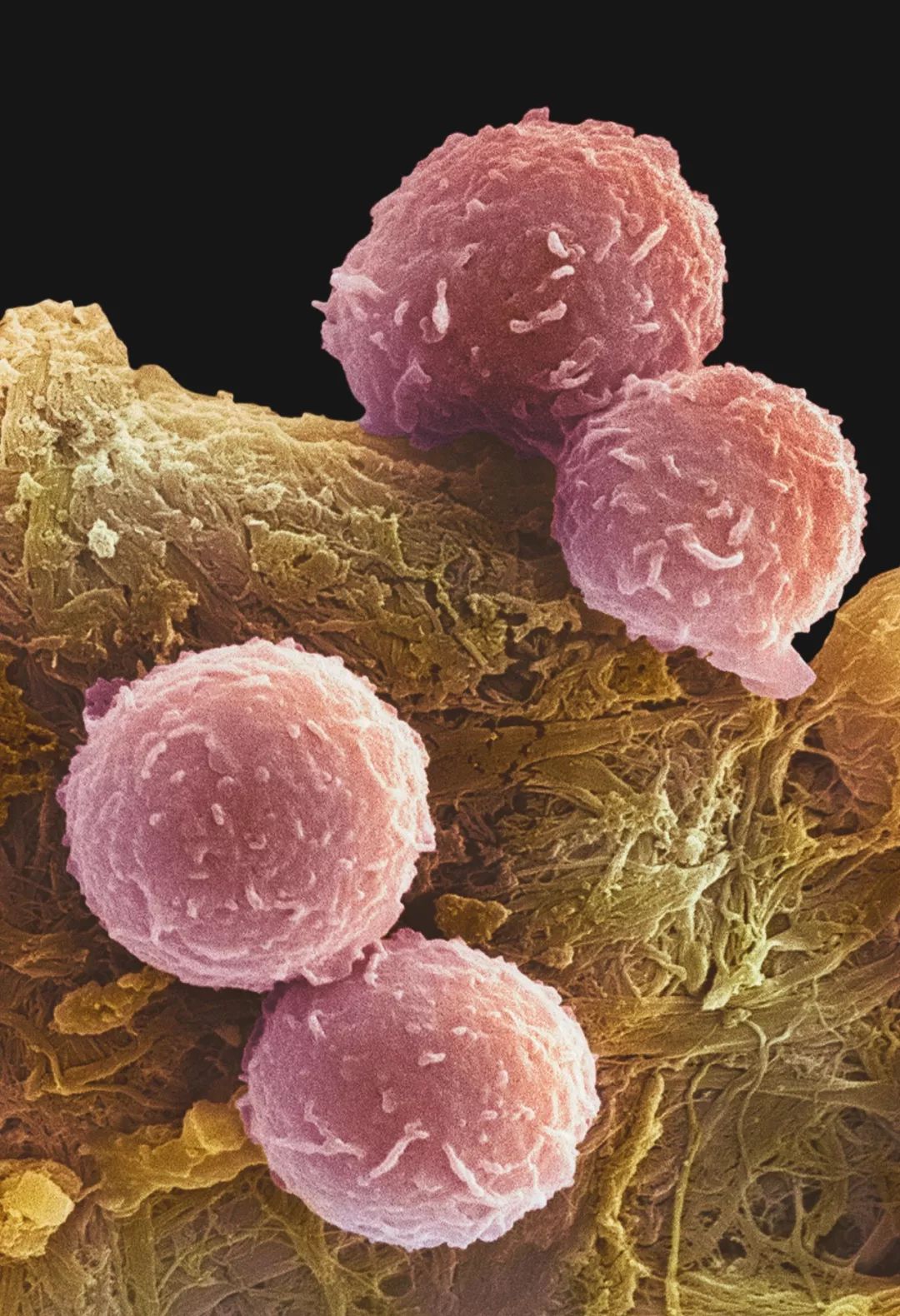 致与病毒搏斗的你！