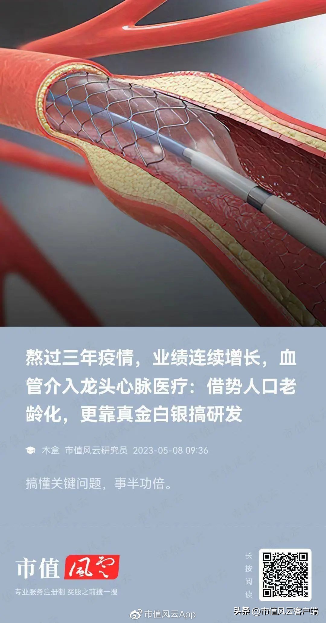 先健科技估值,先健科技业绩大全