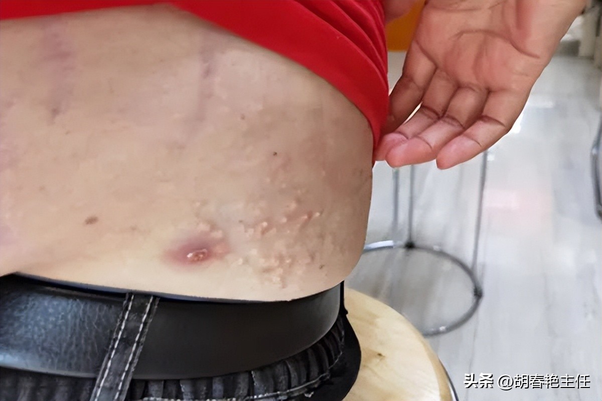 尿酸高会有什么症状和危害,尿酸高的表现症状及调理方法