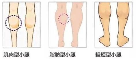 吸脂可以瘦胸吗,吸脂vs瘦腿针