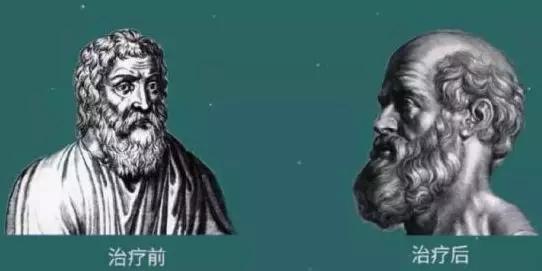 私部毛囊可以植发吗,腋窝的毛可以植发吗