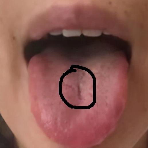 舌诊辨证和精准用药,中医诊病无需诊脉和观舌象靠谱不