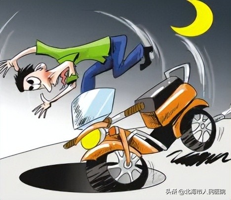 一名男子骑摩托车事故右腿骨折,男子骑摩托车摔成骨折