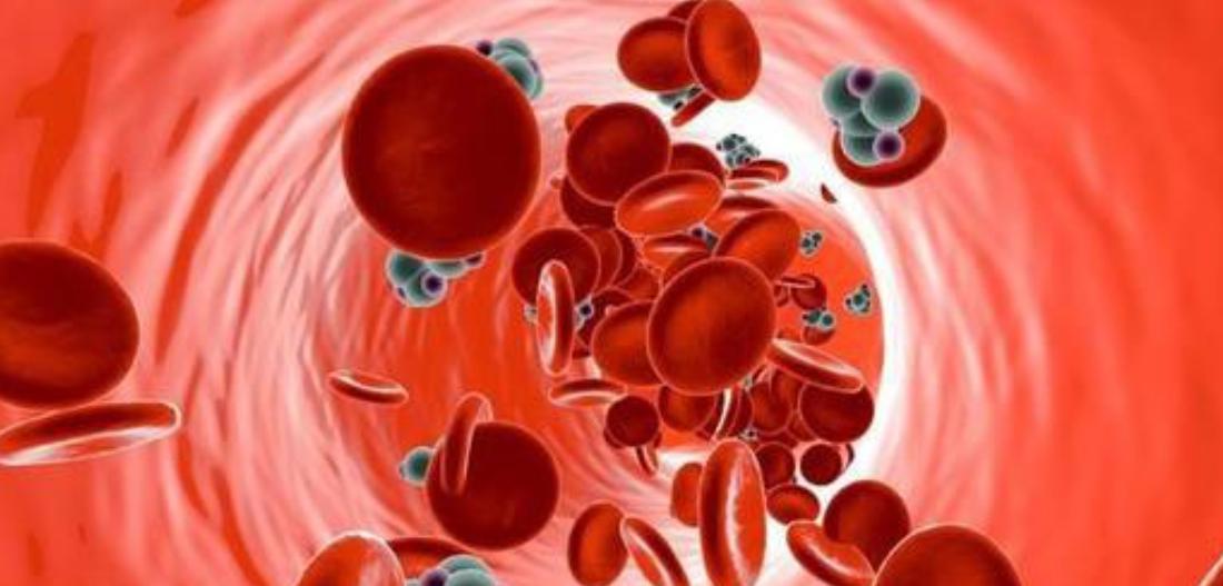 血管堵不堵劝你及时做好4件事,血管不好血难抽如何改善血管