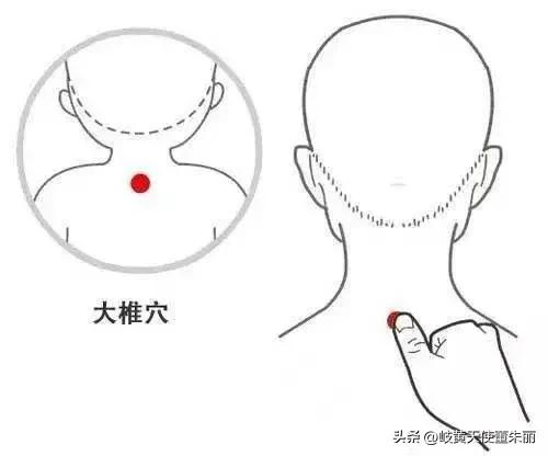 大椎穴疏风解表,大椎穴退烧穴位图解