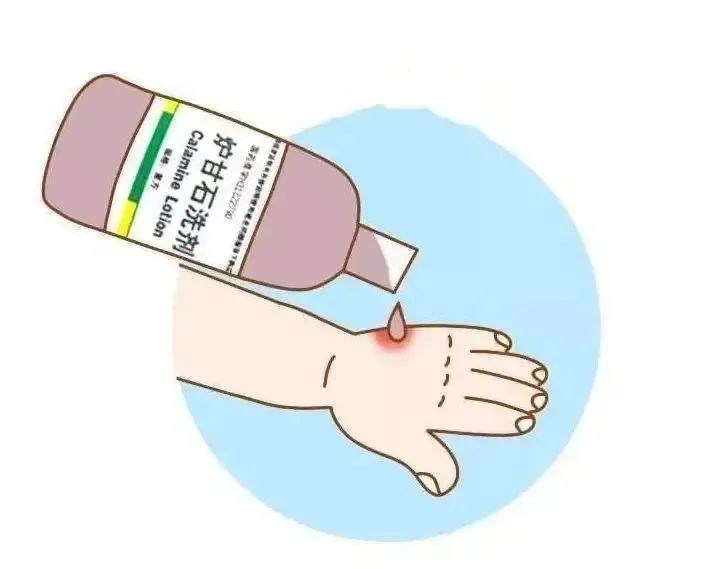 手痒浑身痒是癌的前兆吗,双手痒十几年反反复复可能是癌吗