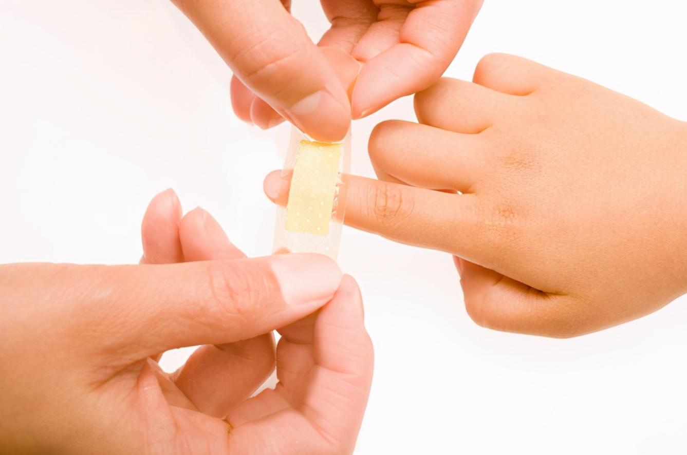 一岁多宝宝脸上破皮,两岁孩子脸破皮