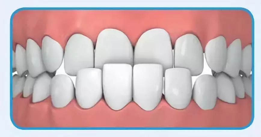 专家提醒：这10种儿童牙齿问题，12岁前千万别拖延，早看早省钱