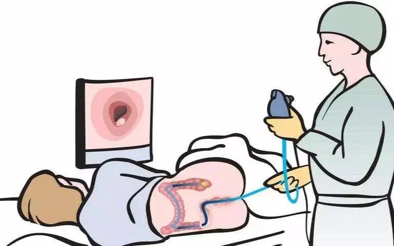 一个小息肉是什么,1毫米息肉会自己消失吗