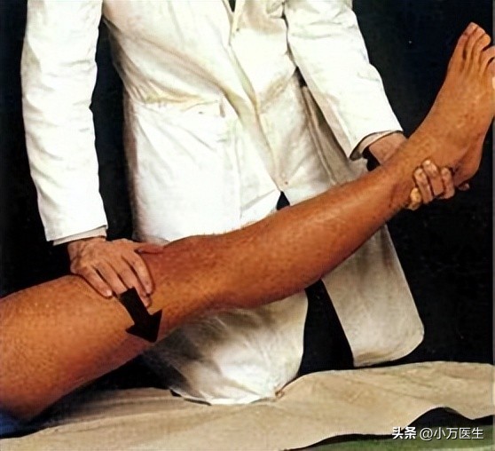 半月板后角撕裂微创手术,半月板撕裂分型