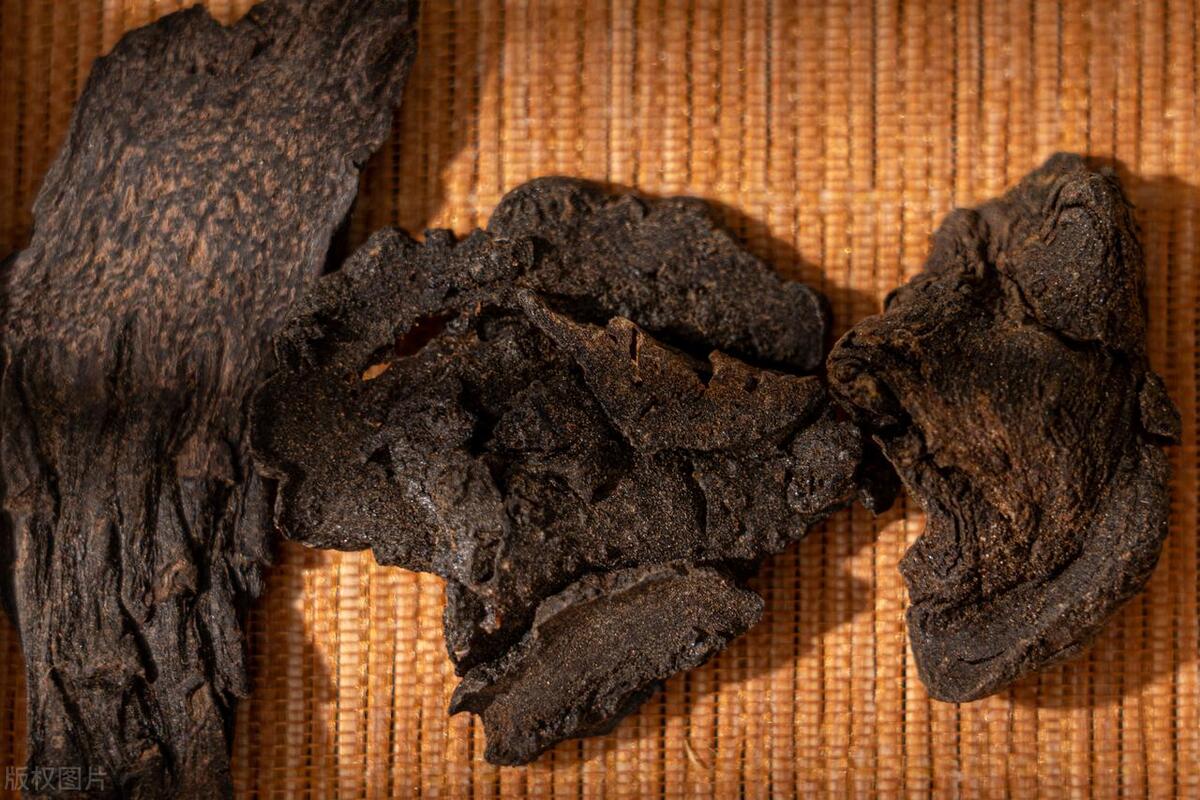 脸上油多下巴和脸颊不停的长痘痘,30岁了脸上出油长痘痘