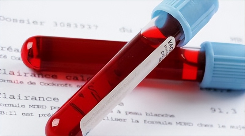 癌胚抗原升高多少可以显示癌症,癌症病人癌胚抗原升高说明什么