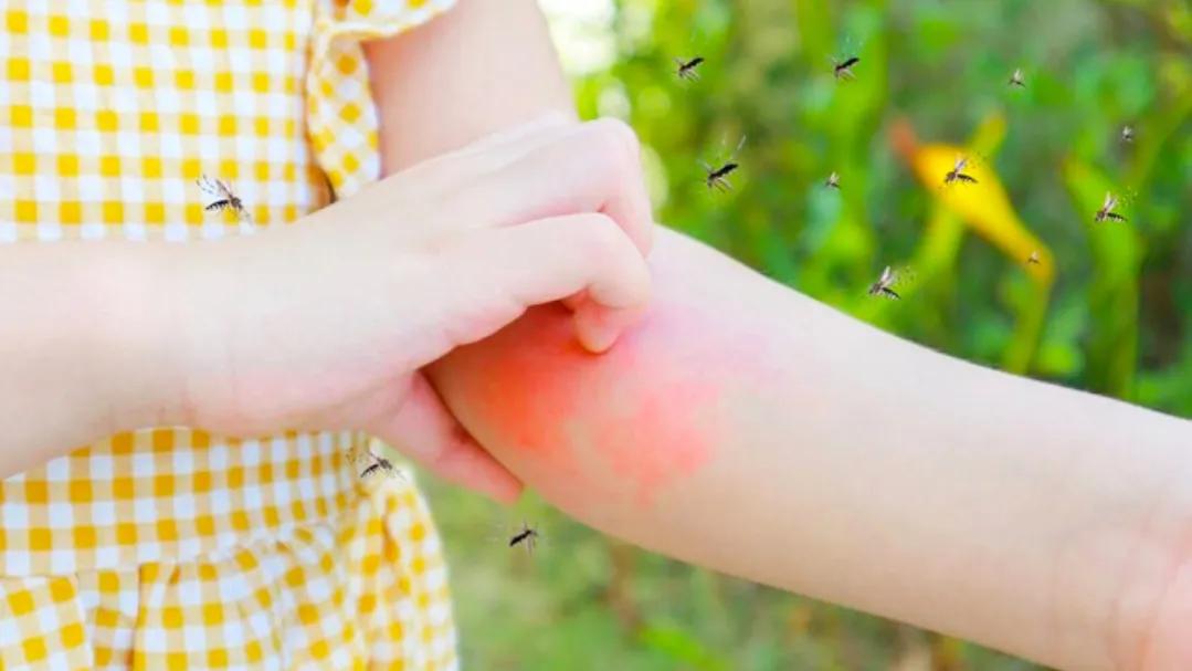 夏天蚊子多宝宝用什么防蚊子,夏天蚊子太多小孩怎么防蚊子
