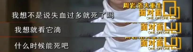 周岩毁容后图片,被毁容的周岩近照